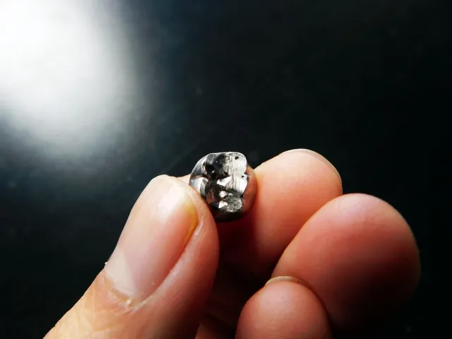 歯の詰めものが取れた際の注意点を解説